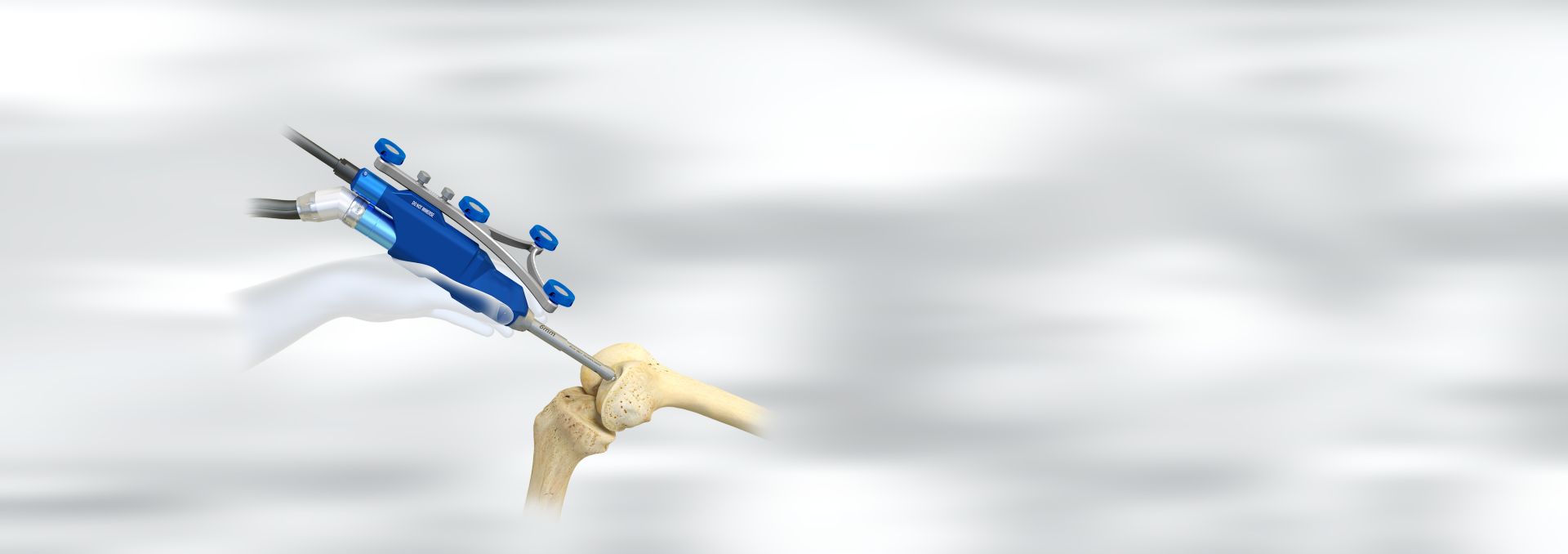 robotiki-arthroplastiki